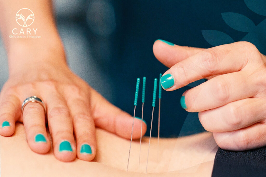 Person receiving dry needling service on their back.